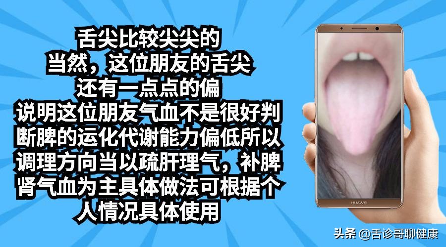 抖音舌诊哥舌象分析与感悟,舌诊歌的分析