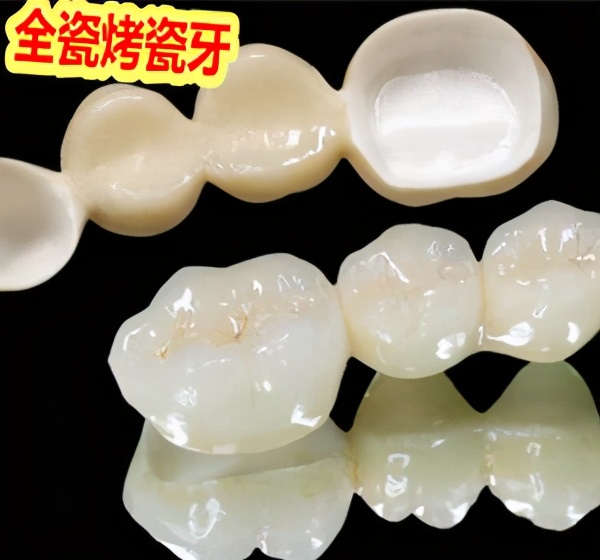 树脂牙和全瓷牙的区别,牙科医生讲座视频大全