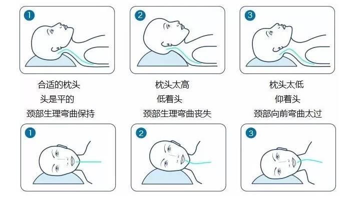 调整坐的姿势改善驼背,调整坐姿走姿让腿越来越直