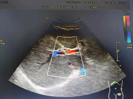 b超是英文字母缩写吗,b超为什么是圆形的