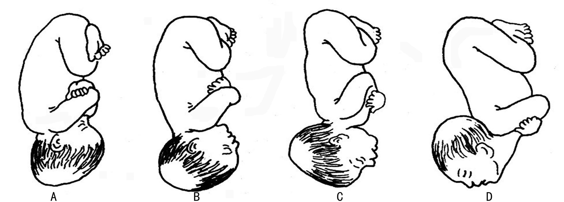 双胎什么时候做胎儿系统超声检查,双胎彩色超声检查