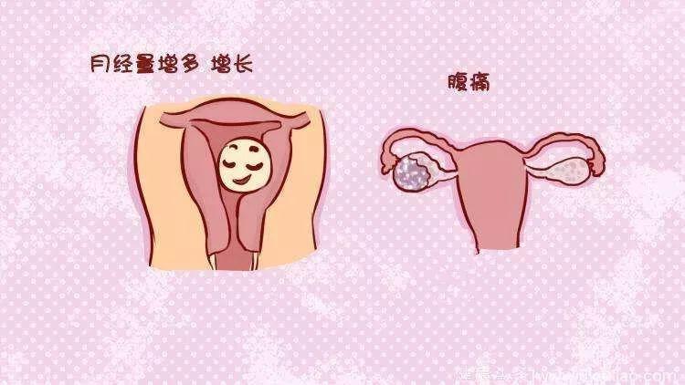 子宫肌瘤患者真的不能食红枣吗,医生说子宫肌瘤不能吃豆制品海鲜