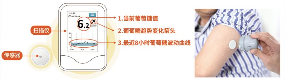糖友的视频,糖友记录软件