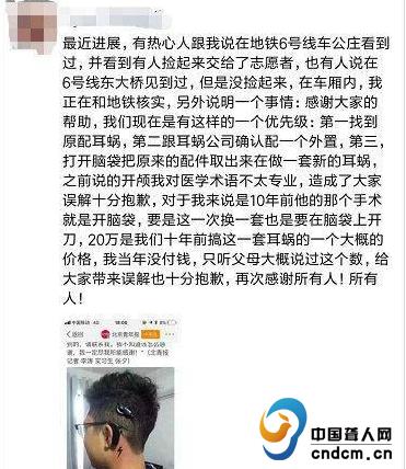 人工耳蜗丢失事件后续 (人工耳蜗丢了真实事件)