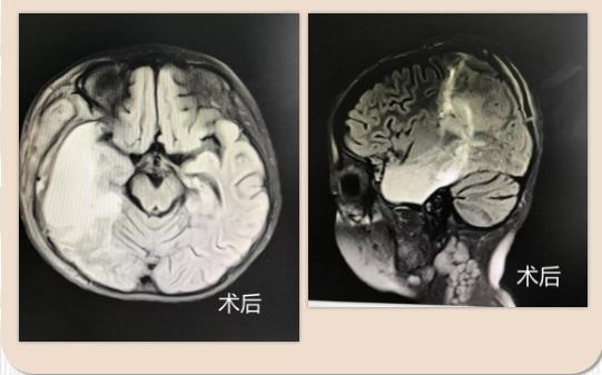 家有癫痫孩子家长焦虑,孩子癫痫家长崩溃