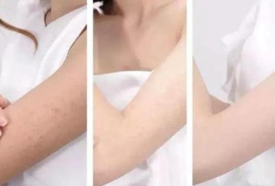 长期涂身体乳会长毛吗,长期涂身体乳对比照