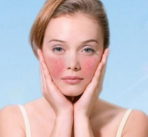 敏感肌肤起皮发痒发红怎么办,皮肤干痒的小妙招