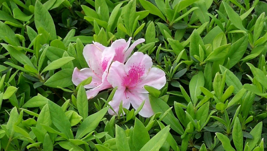 硬膜外血肿意识清醒需要手术吗,急性硬膜外血肿可做什么检查