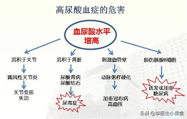 痛风发作怎么缓解疼痛医生这样讲,痛风发作怎么办一招教你缓解痛风