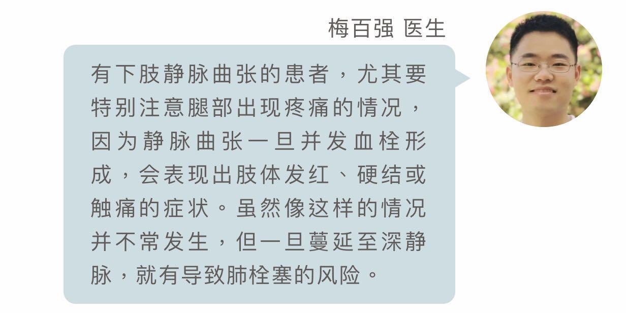 下肢静脉曲张酸胀痛有办法！简单三招来应对
