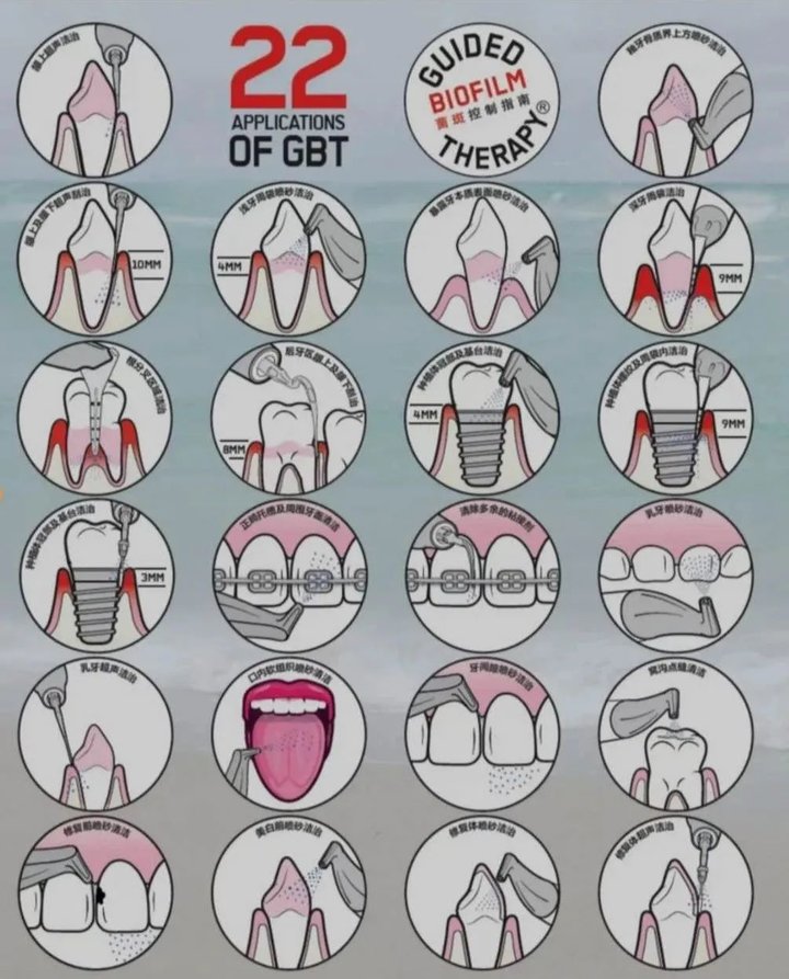 德州口腔医院洗牙团购,德州牙科整牙