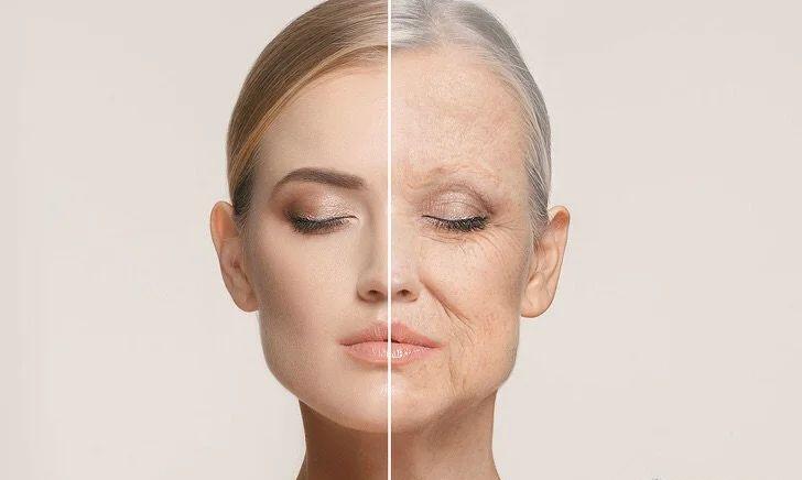 老化毛孔粗大能收缩回去吗,挤完黑头毛孔粗大能缩回去吗