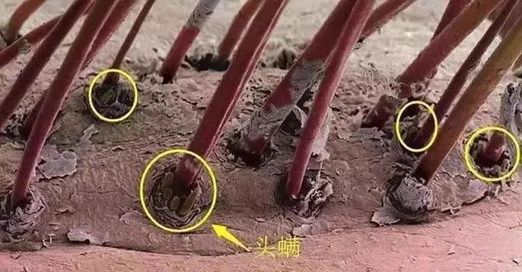 头油头皮屑多脱发洗发水,头油头皮屑多洗发水推荐