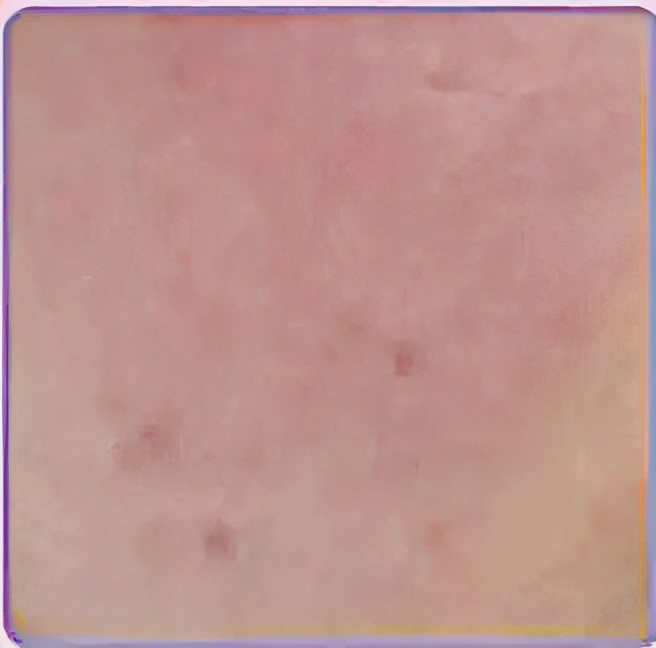 脸泛红是敏感肌还是过敏怎么判断,脸部敏感肌过敏是什么样的