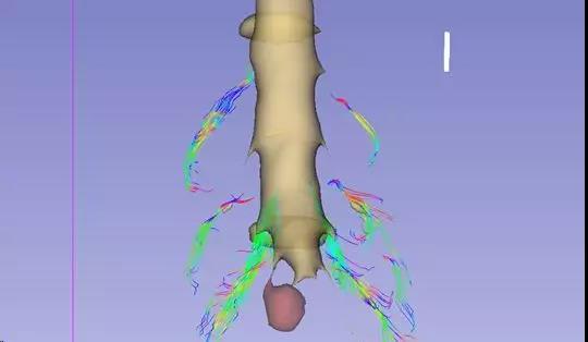 腰腿疼是哪些经络阻塞,腰囊肿疼是怎么回事