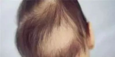 婴儿护理应注意的200个细节,0-100天婴儿护理的60个注意事项