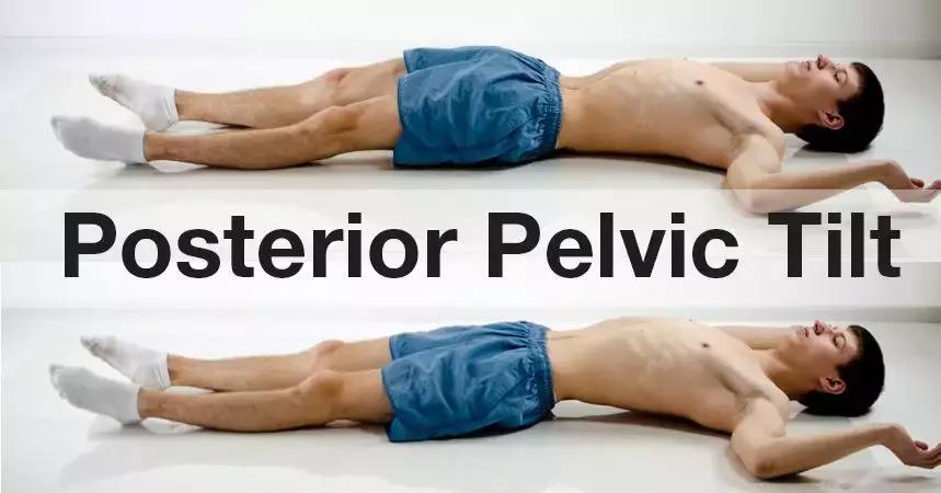 骨盆前倾后倾侧倾危害,骨盆后倾的普拉提训练动作有哪些