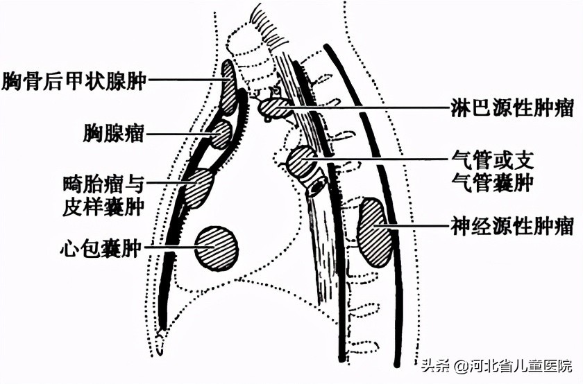 9个月大的孩子，总是咳咳咳咳咳咳咳咳咳咳，原因找到了