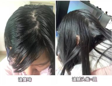 澳洲茶树精油洗发水去头屑,头发一摸全是油