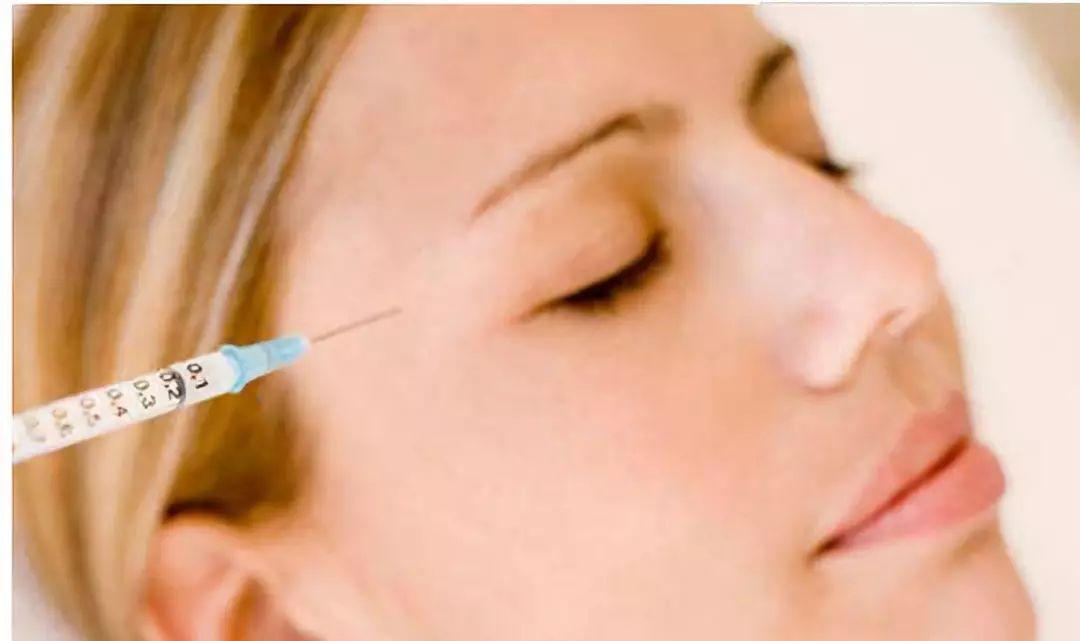女明星每天注射玻尿酸,女明星都打玻尿酸吗