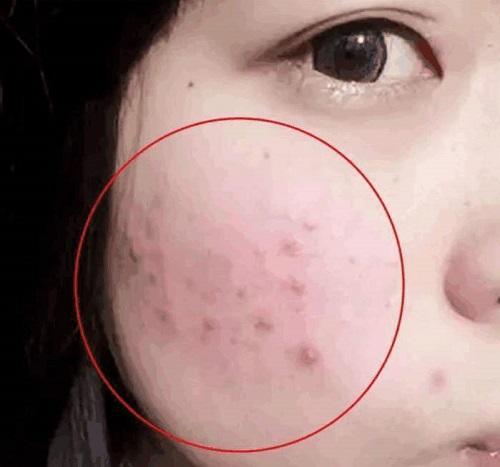 几块钱的硫磺皂解决家里的大问题,几块钱的硫磺皂能不能用