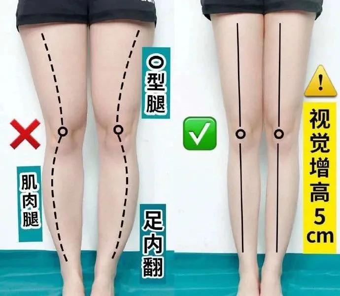 练腿攻略：3个简单动作，消除顽固型小腿外翻