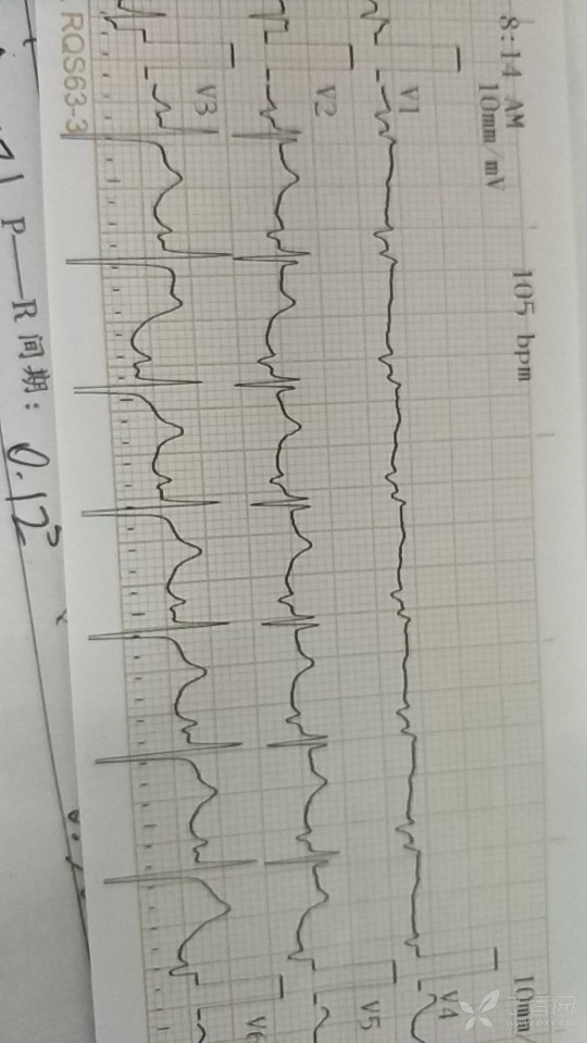 治咳喘的穴位太渊穴图,咳喘穴和太渊穴在哪里