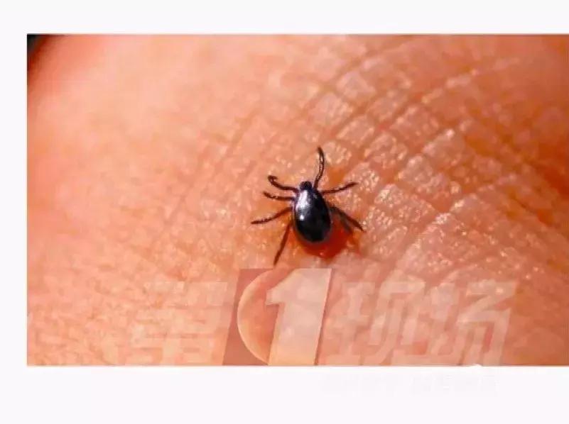 儿童被不明虫子咬了肿一大块止痒,小朋友被虫子咬了的危险视频