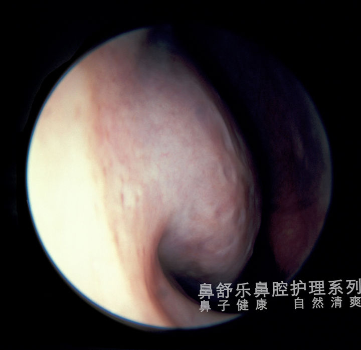 现在怎么那么多鼻炎馆,专门的鼻炎馆管用吗