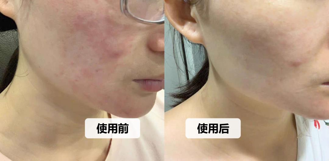 打假不要私自找卖家谈,打假不要再被骗