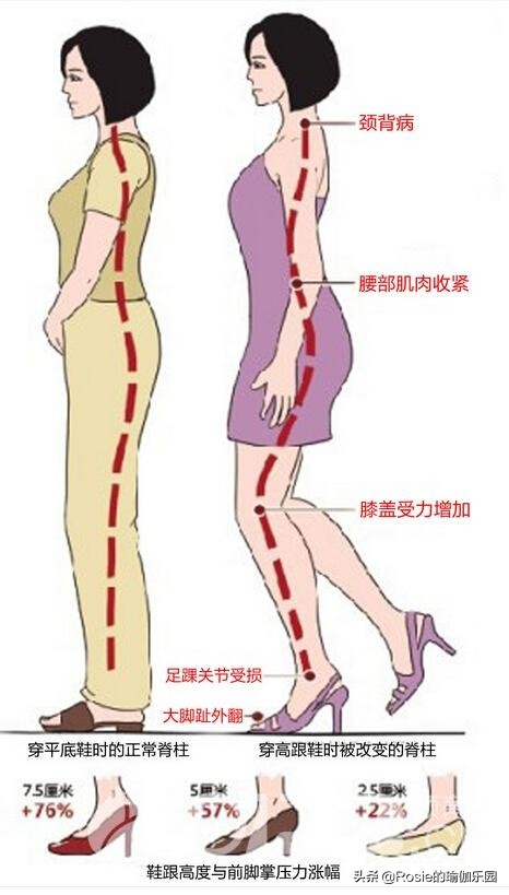 穿高跟鞋膝盖疼痛怎么缓解,穿高跟鞋如何防止脚累疼