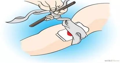 运动损伤的治疗与康复知识点,运动损伤的诊治