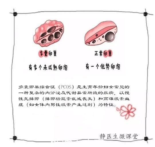 多囊卵巢备孕亲身经历,静医生备孕怎么收费