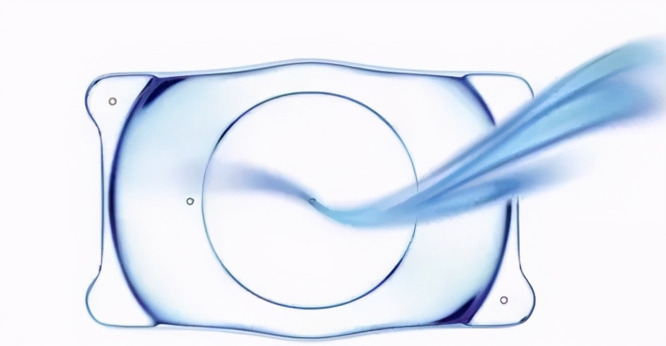 目前控制近视度数有哪些方法,角膜塑形镜停戴后近视度数飞涨