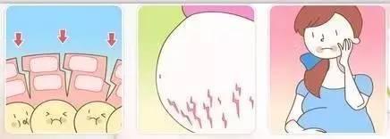 怀孕长妊娠纹了怎么补救,妊娠纹修复真的可以祛除妊娠纹吗