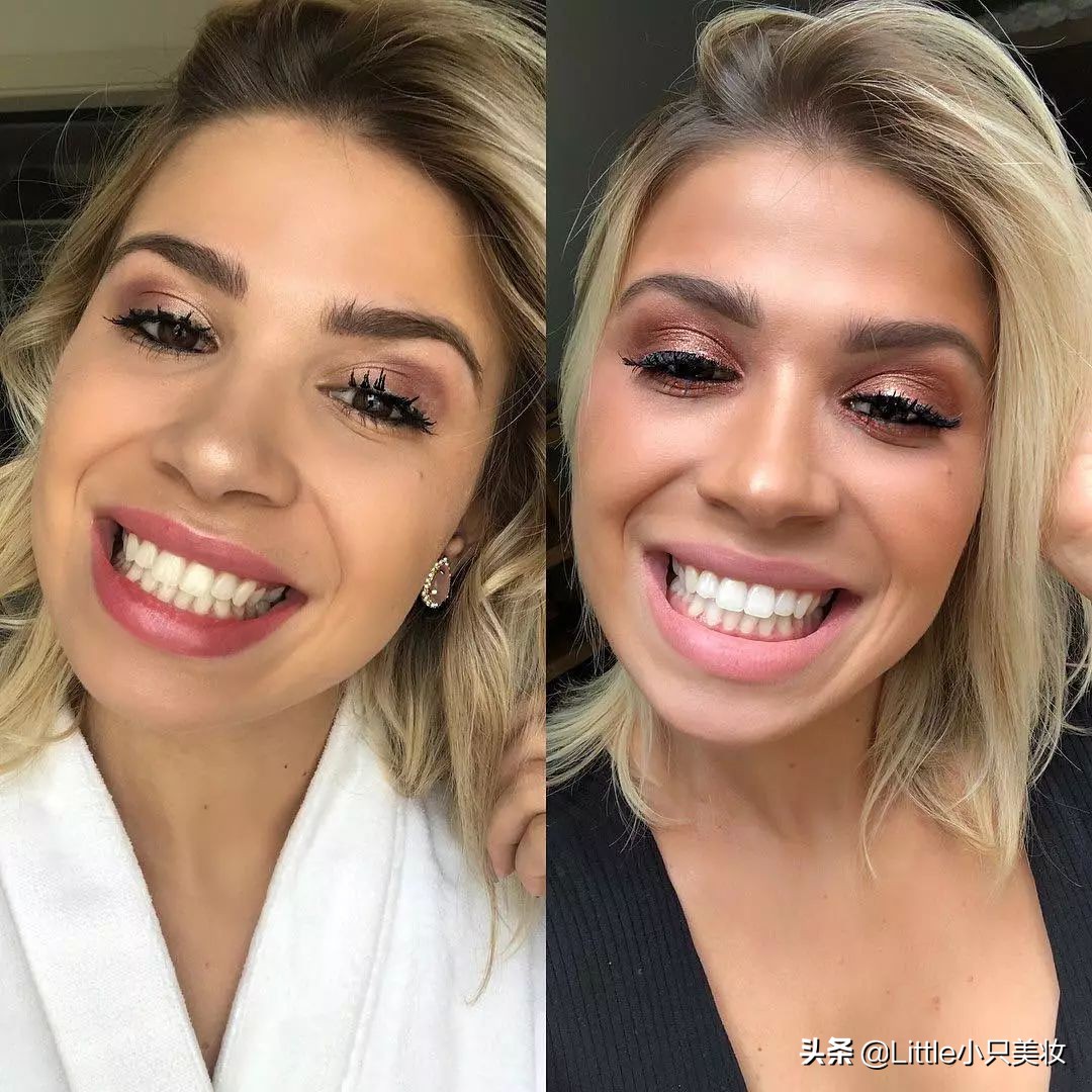 黄牙妹用什么美白,最全牙齿美白攻略