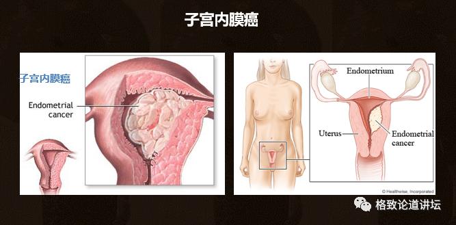 身为女人的我们如何保护好自己,作为人类我们如何保护地球