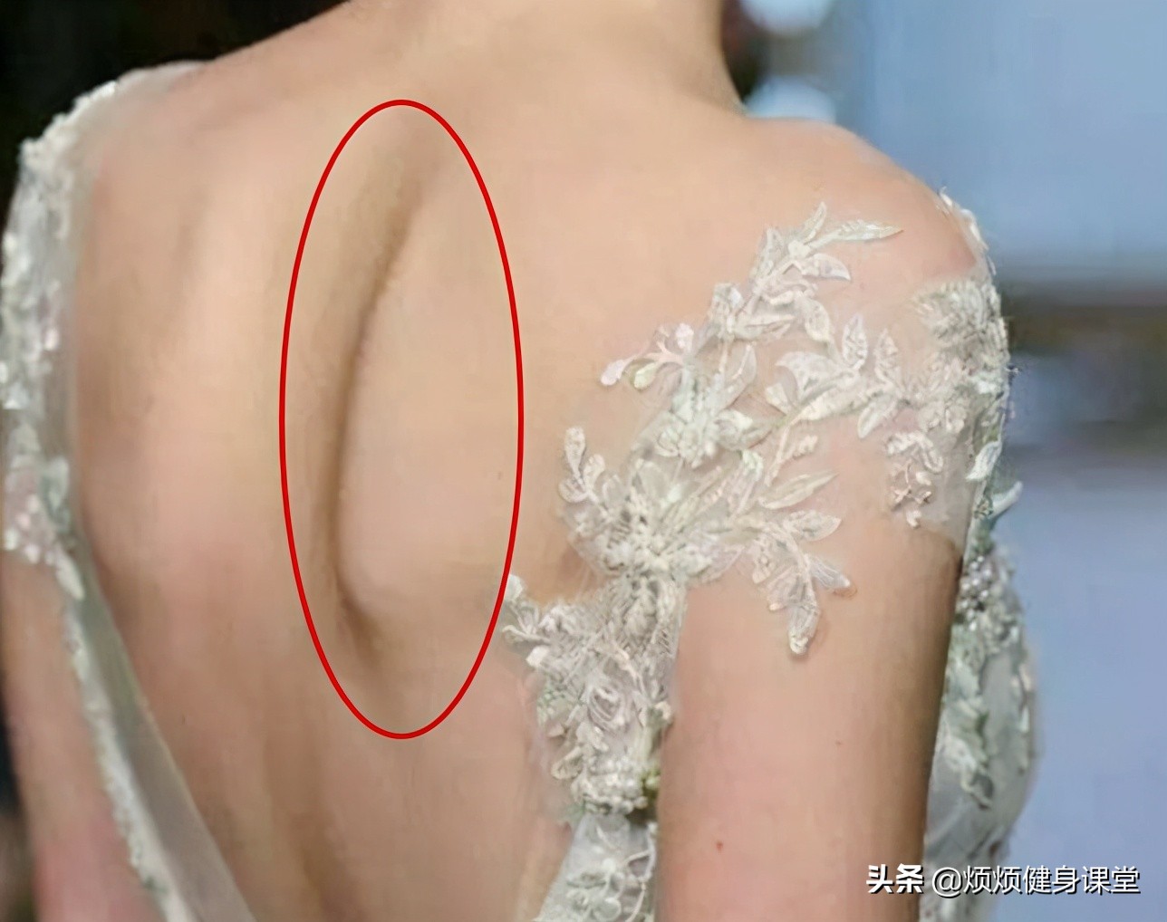 帕梅拉10分钟改善圆肩驼背,改善圆肩驼背的最有效动作
