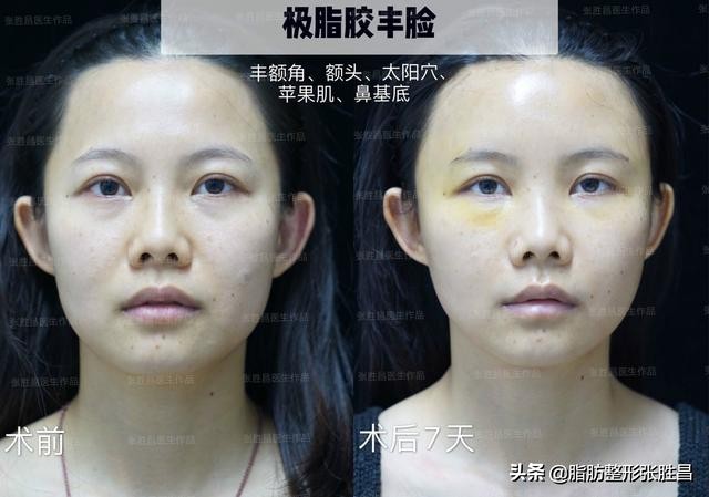 快速有效暴瘦腰腹练出马甲线,紧致身材零赘肉这样健身才最有效