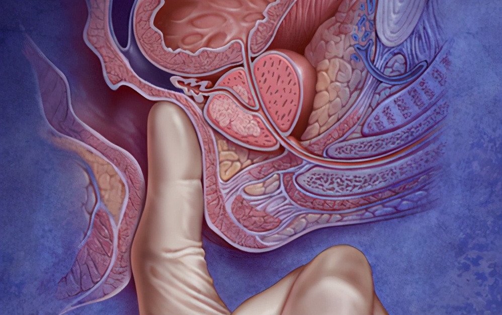 堪比生孩子的疼痛,号称比生孩子还疼的肛周脓肿手术