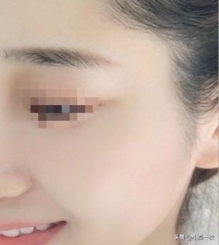 做医美真的可以变美,做什么医美可以让皮肤透亮