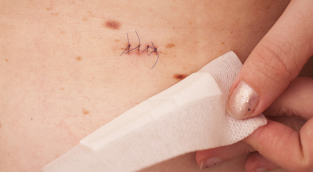 哪些小耳畸形患者无法进行耳畸形矫正手术