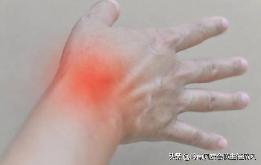 专家谈痛风用药技巧,医生科普痛风如何防治