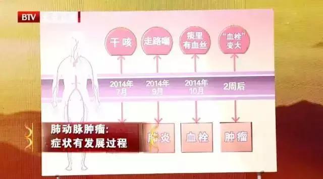 常见恶性肿瘤的警告信号,医生总结了恶性肿瘤的八个信号