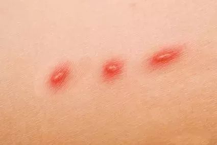 养猫得真菌头癣辟谣,养猫辟谣