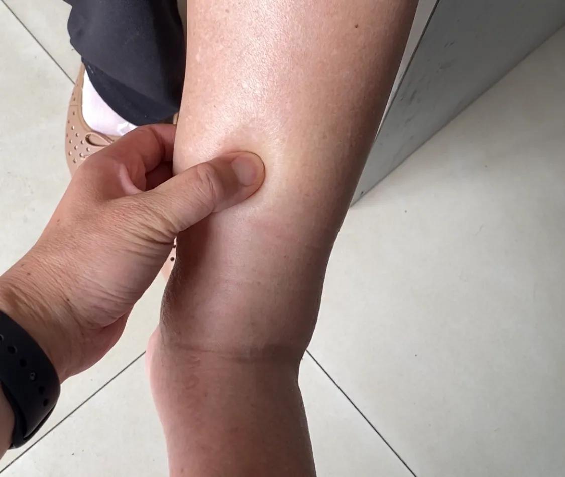 t波改变会导致双下肢浮肿吗,老人双下肢浮肿什么原因