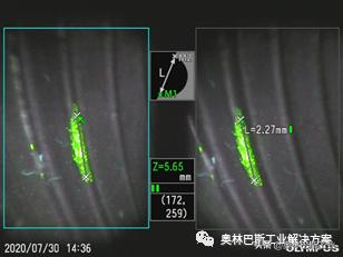 奥林巴斯内窥镜视频,奥林巴斯内窥镜技术