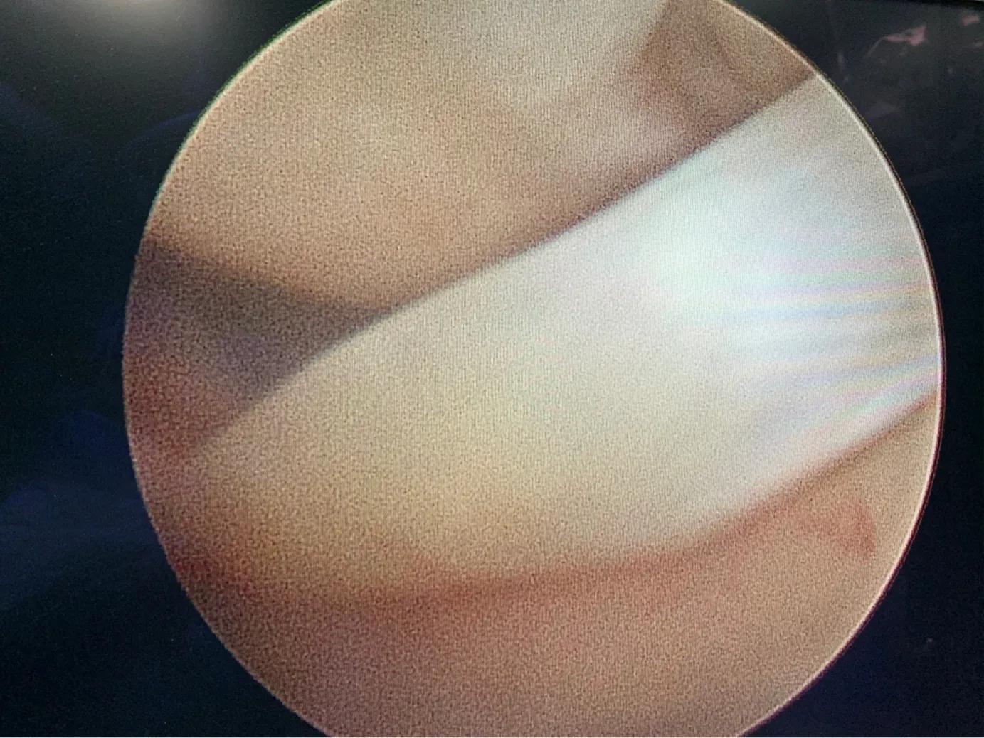 下蹲是按住好还是切换好,下蹲正确与错误对比图