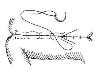 外科缝合方法笔记,兽医外科手术中最常用的缝合方法