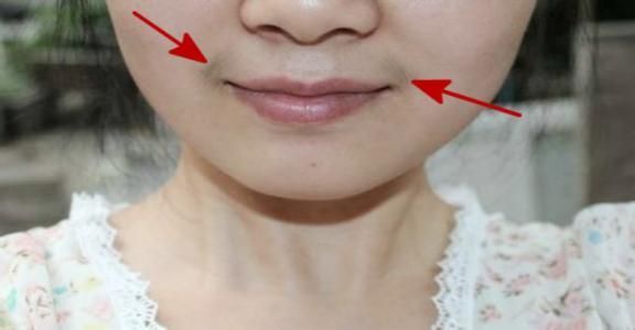 13岁了女孩有胡子咋办,青春期的孩子长胡子怎么处理